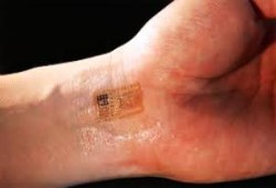 Microchip sottocutanei